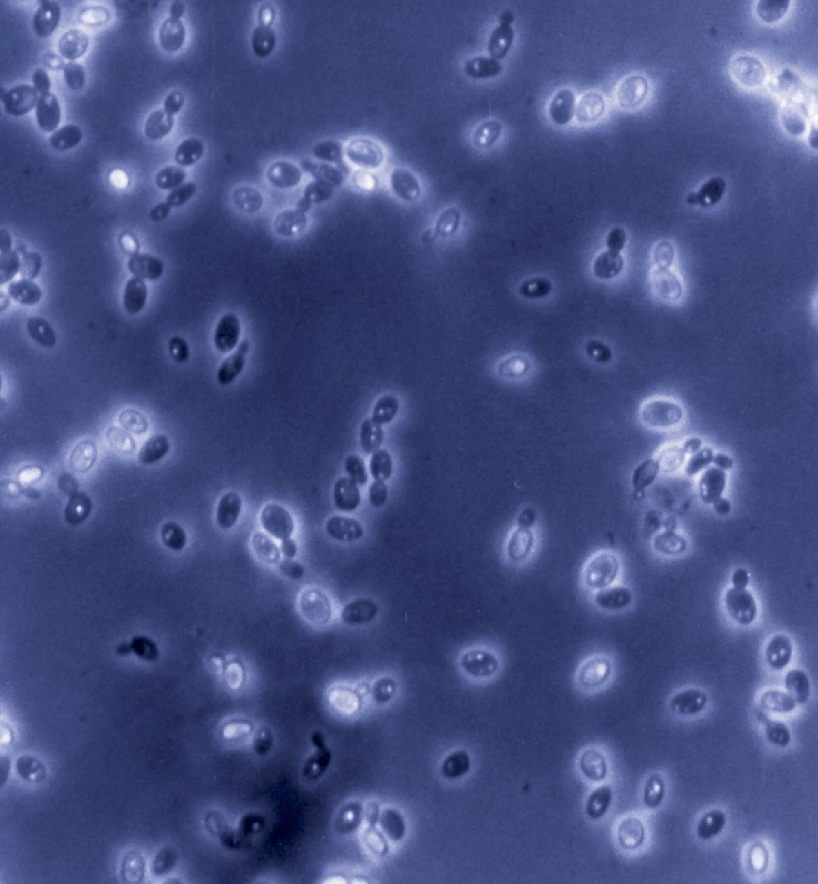 Backhefen - Saccharomyces cerevisiae - Zellen unter dem Mikroskop